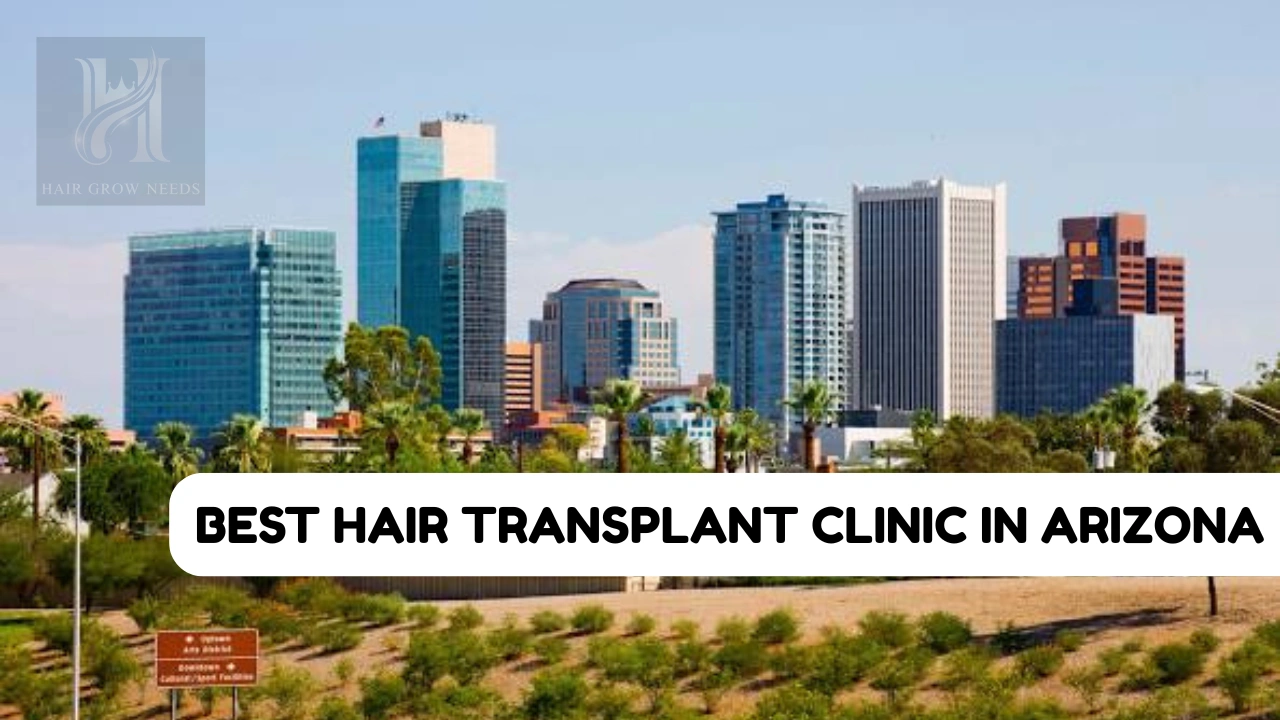 Best Hair Transplant Clinic In Arizona