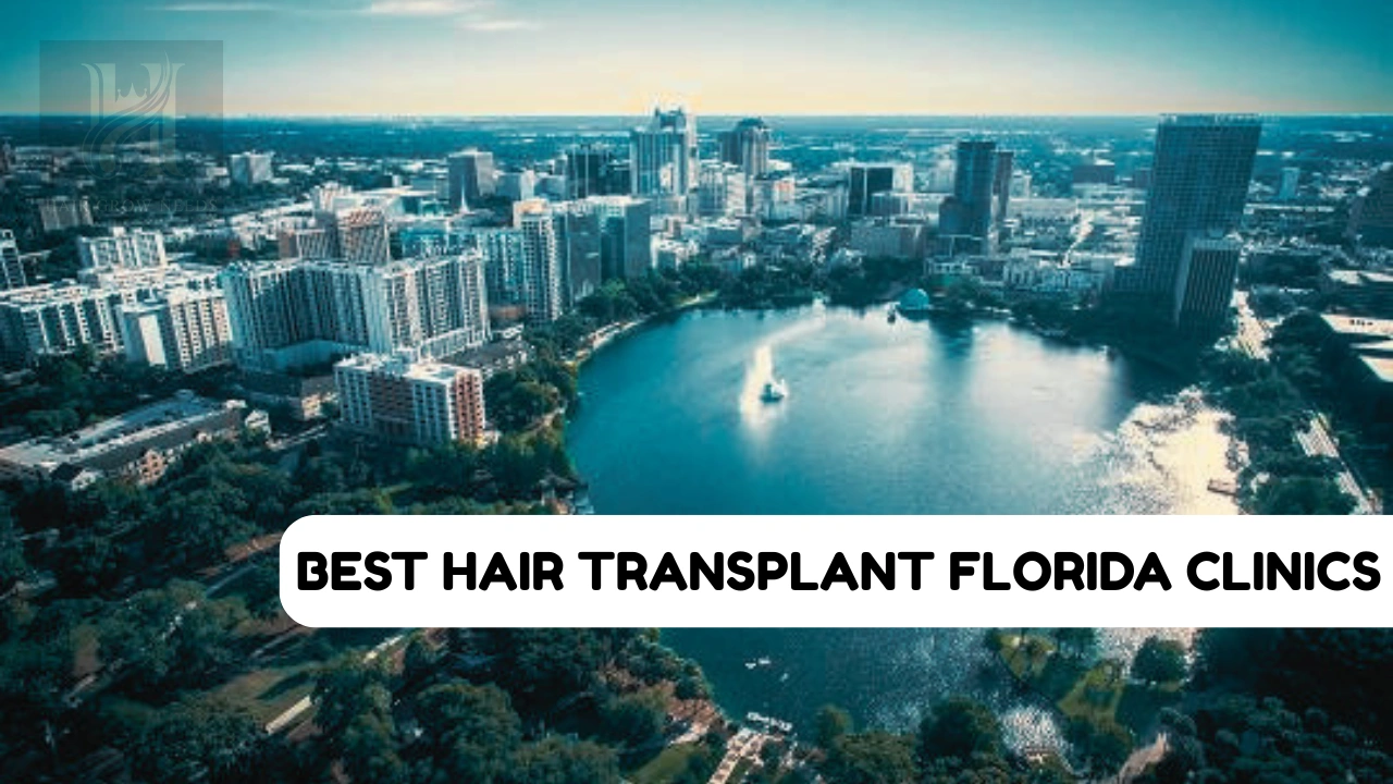 Best Hair Transplant Florida USA