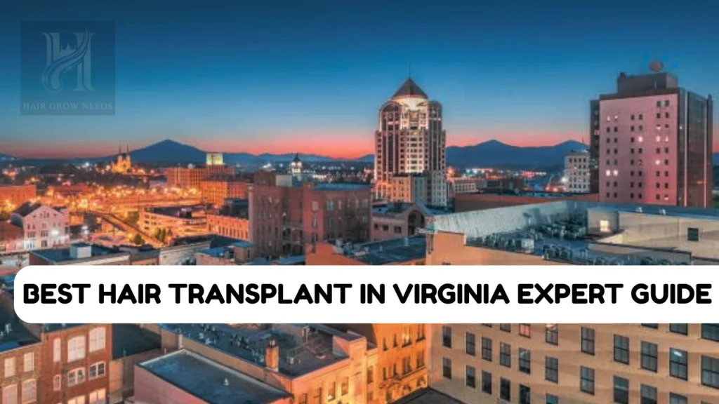 Best Hair Transplant in Virginia