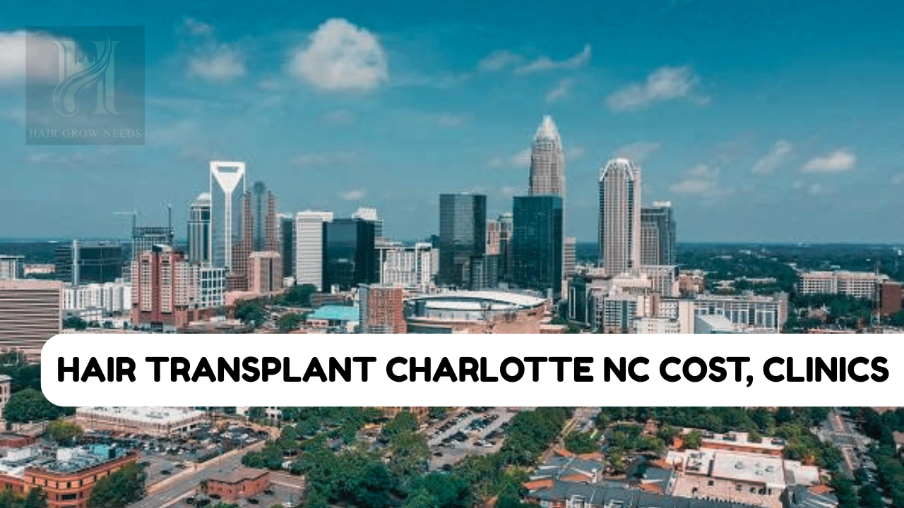 Hair Transplant Charlotte NC Cost, Clinics
