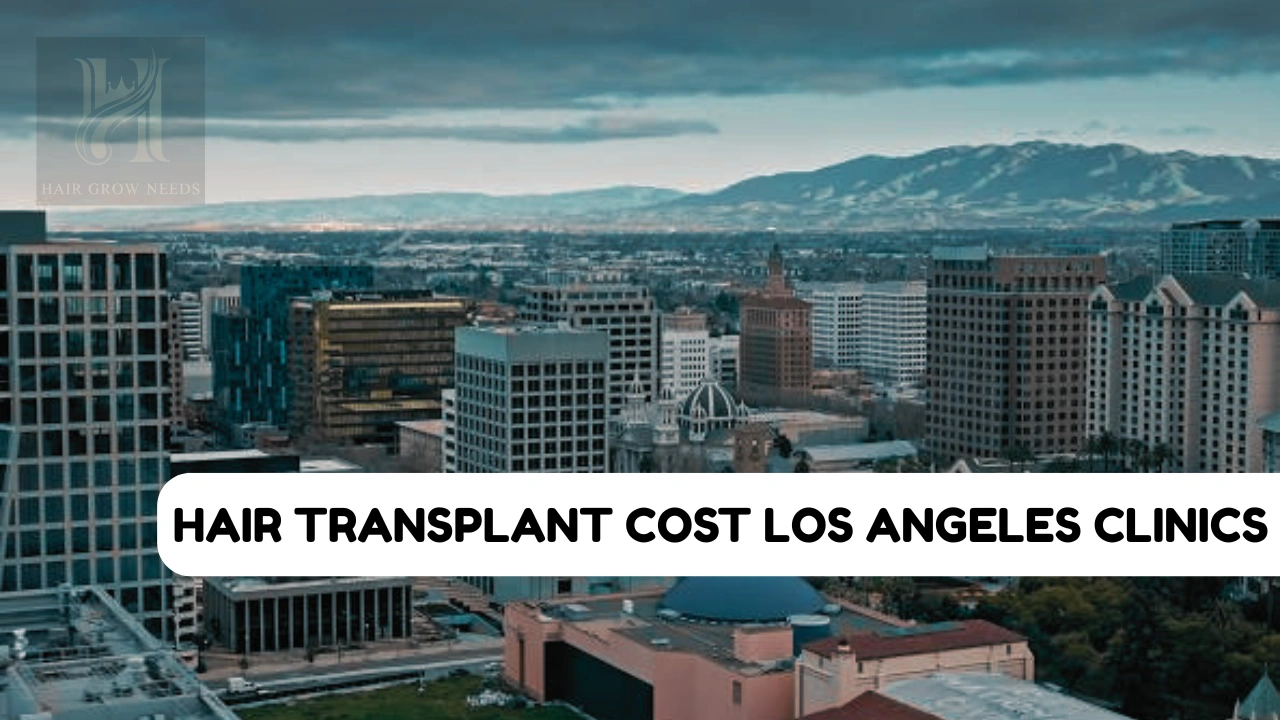 Hair Transplant Cost Los Angeles USA