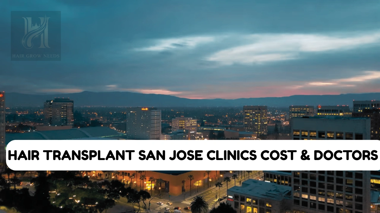 Hair Transplant San Jose