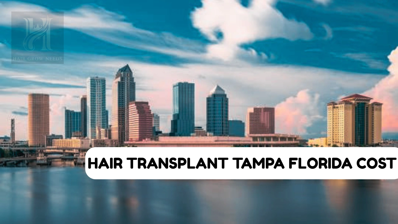 Hair Transplant Tampa Florida Cost USA