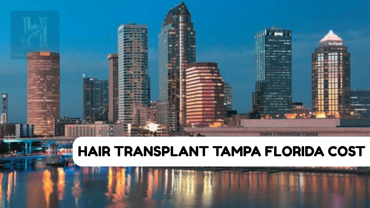 Hair Transplant Tampa Florida FL USA
