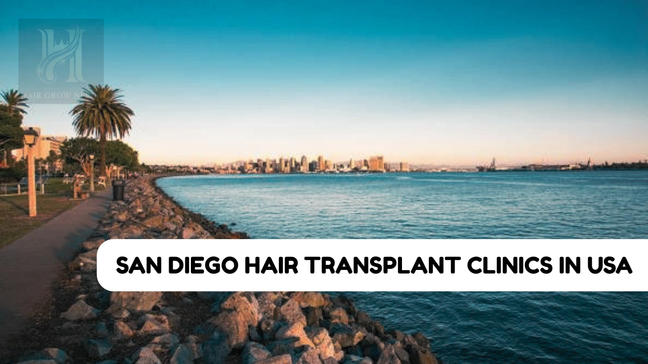 San Diego Hair Transplant