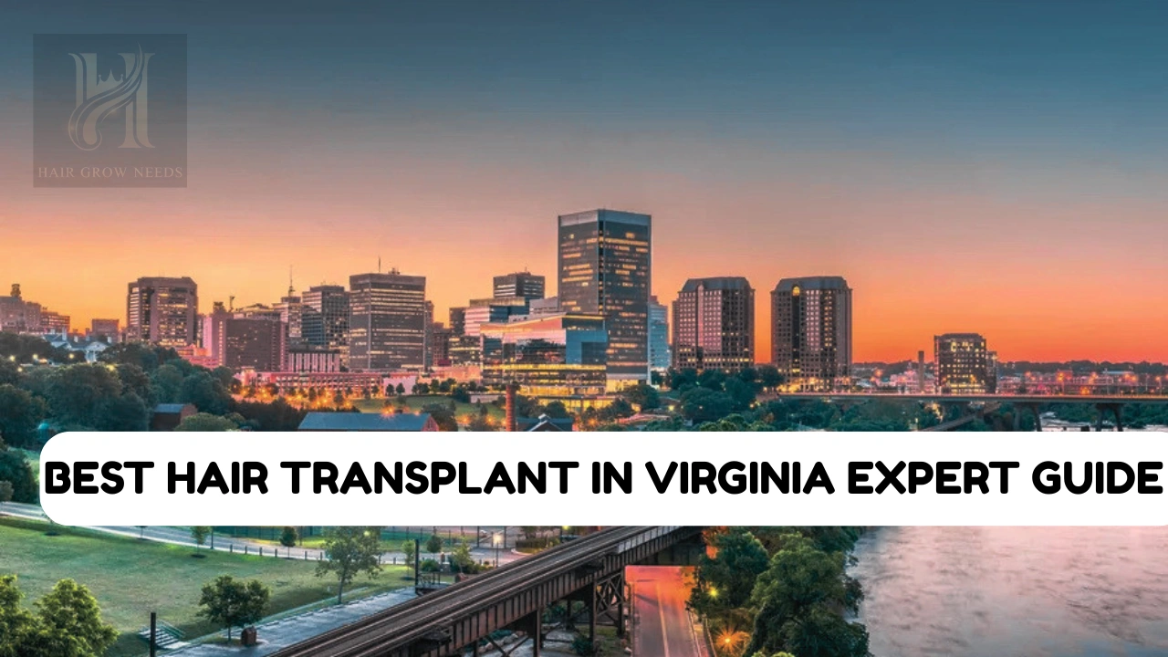 best hair transplant in virginia​