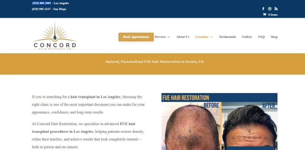 Concord Hair Restoration (Encino/Los Angeles) - Dr. Ben Mousavi