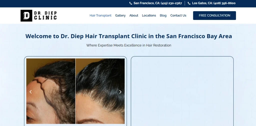 Medical Hair Transplant & Aesthetics (Dr. John Diep) Los Gatos / San Francisco, CA: