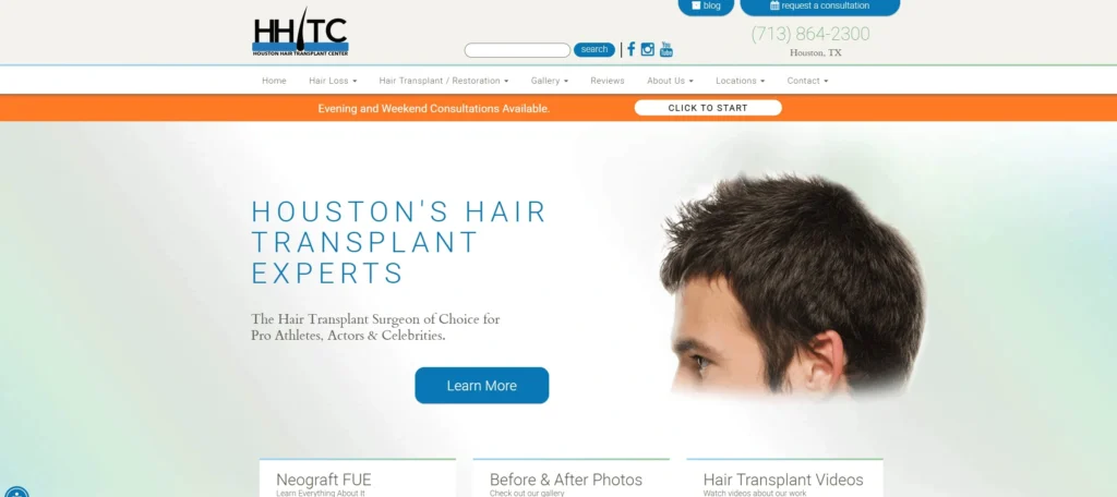 Houston Hair Transplant Center Houston, TX
