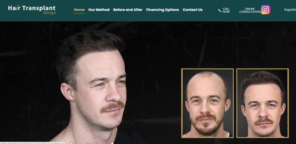 Hair Transplant Design