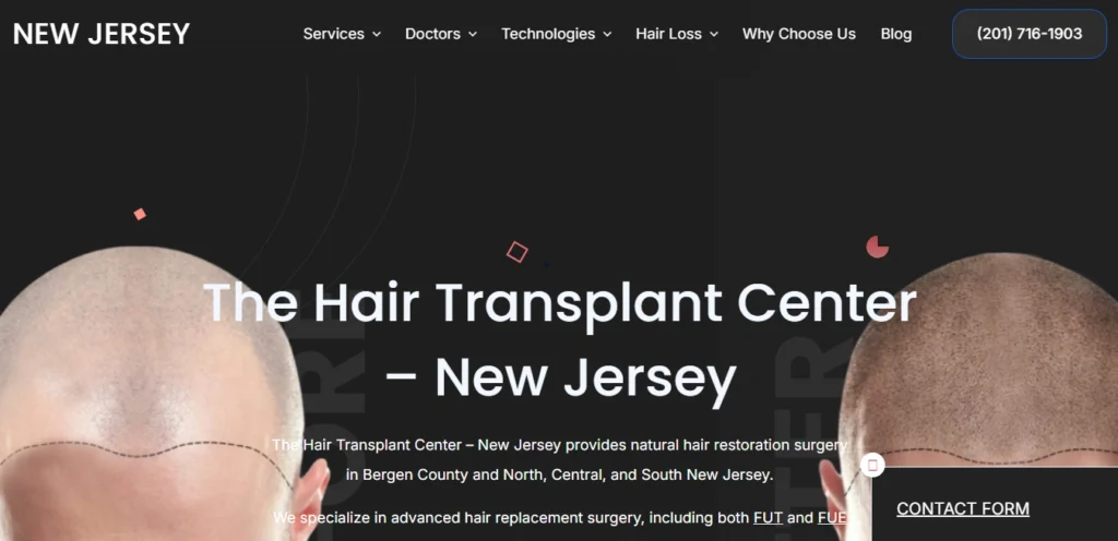 Hair Transplants New Jersey