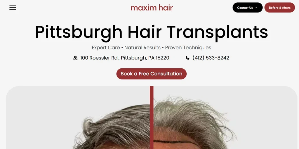 Maxim Hair Restoration 