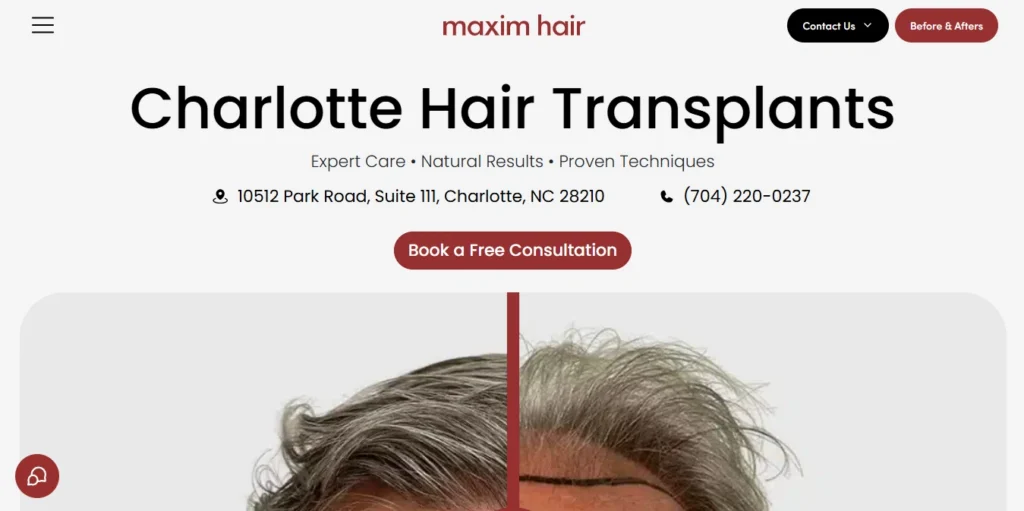 Maxim Hair Restoration & Transplants – Charlotte