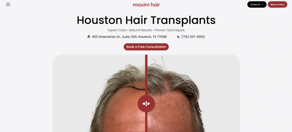 Maxim Hair Restoration