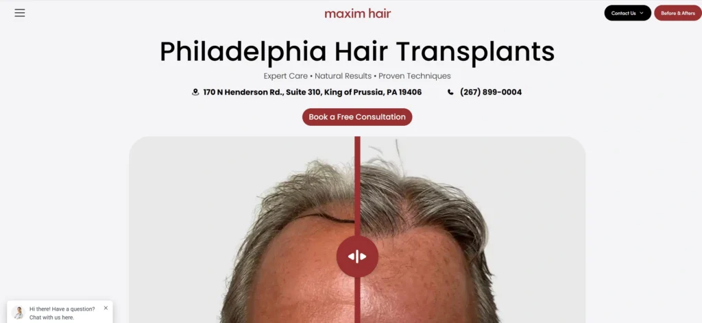 Maxim Hair Restoration & Transplants Philadelphia