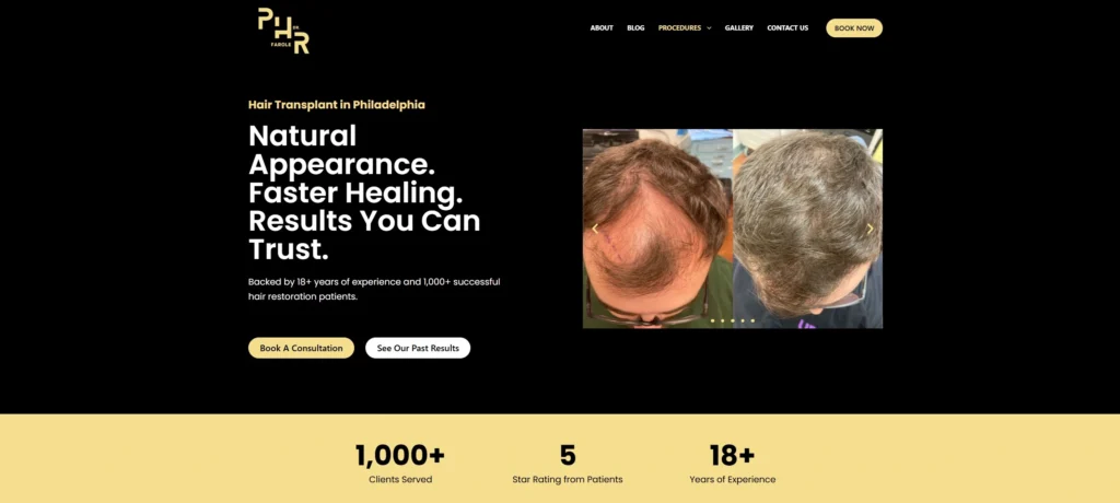 Philadelphia Hair Restoration