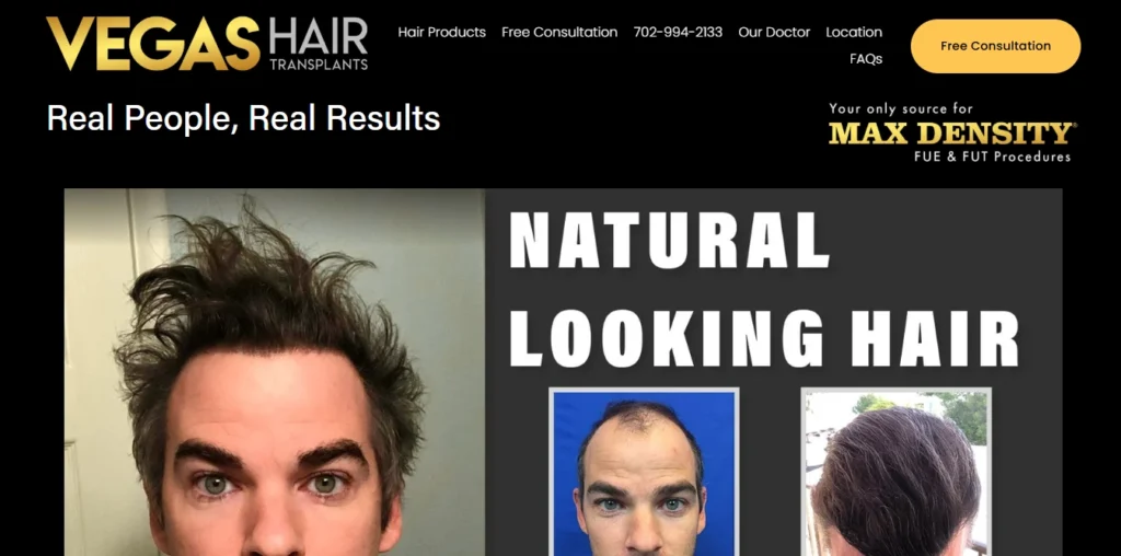 Vegas Hair Transplants