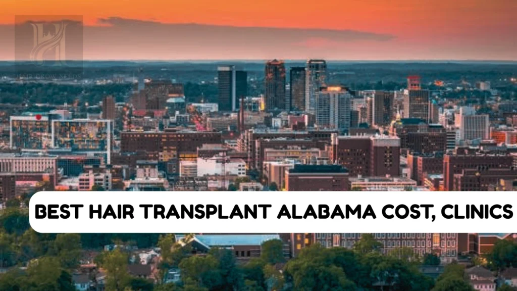 Best Hair Transplant Alabama