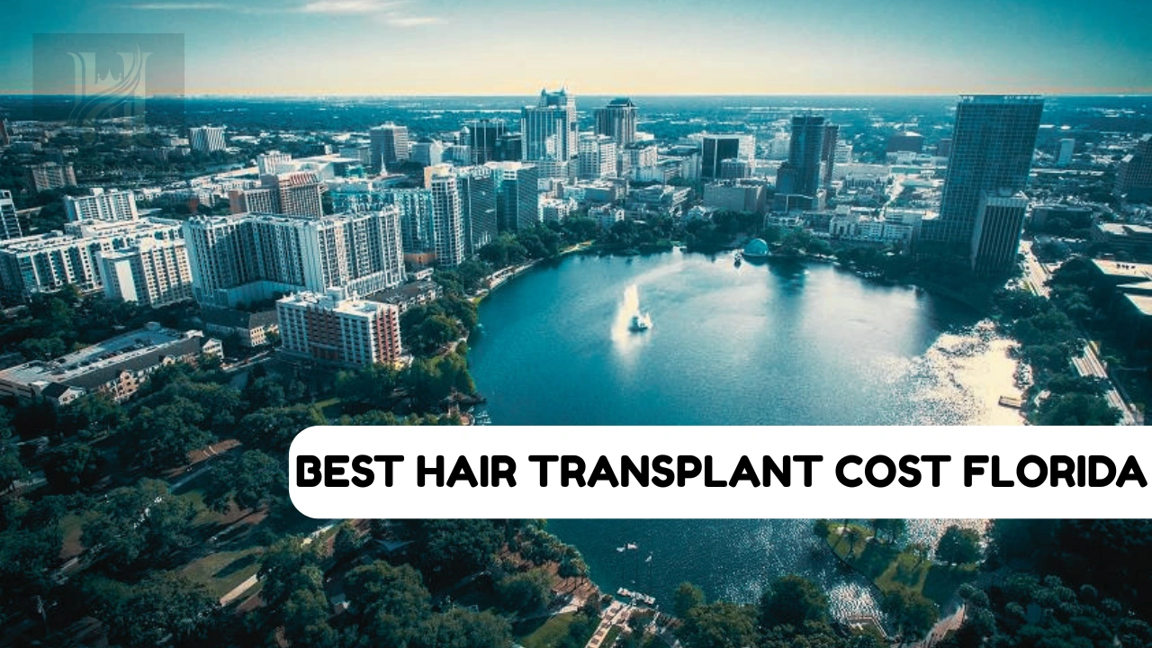 Best Hair Transplant Cost Florida