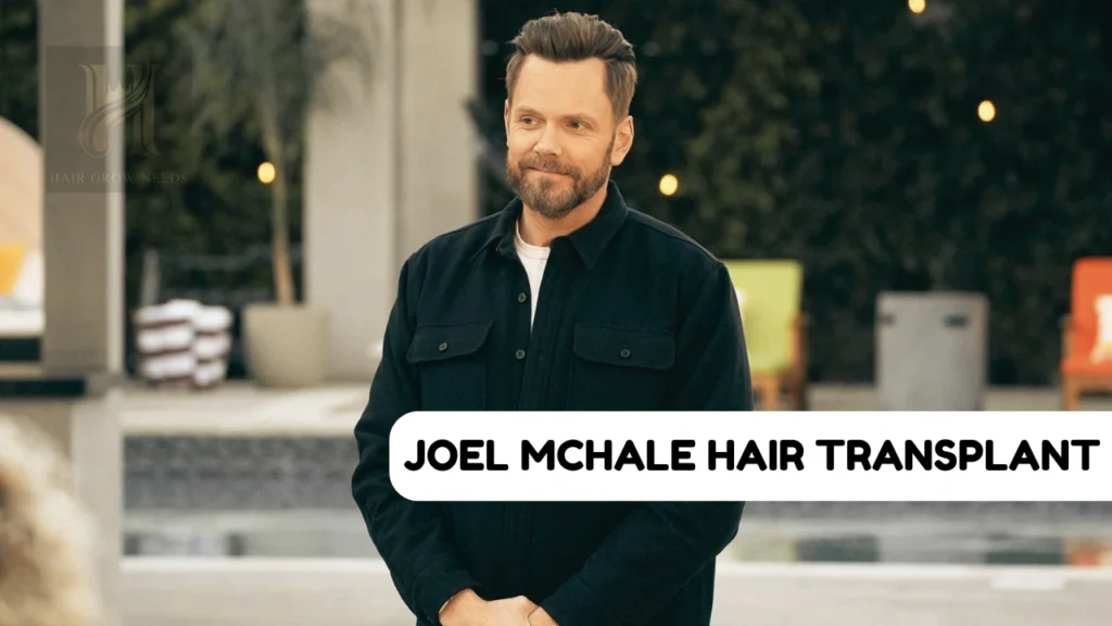 Joel McHale Hair Transplant