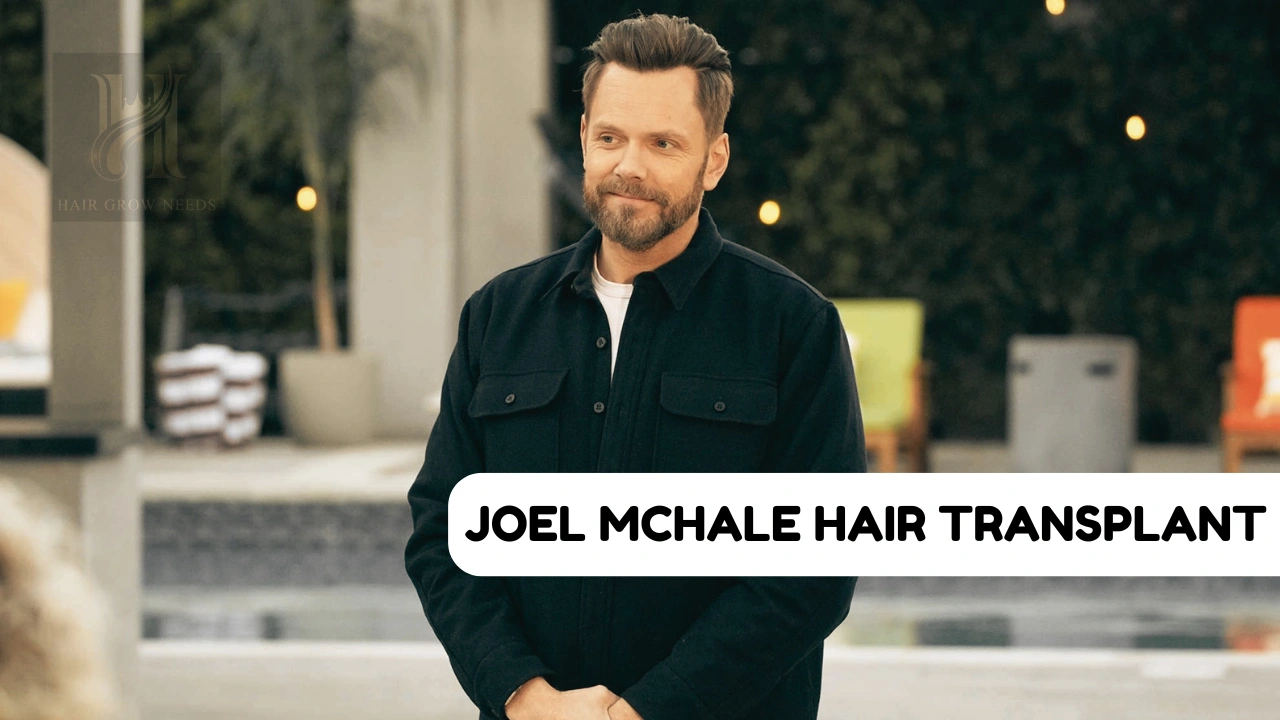 Joel McHale Hair Transplant