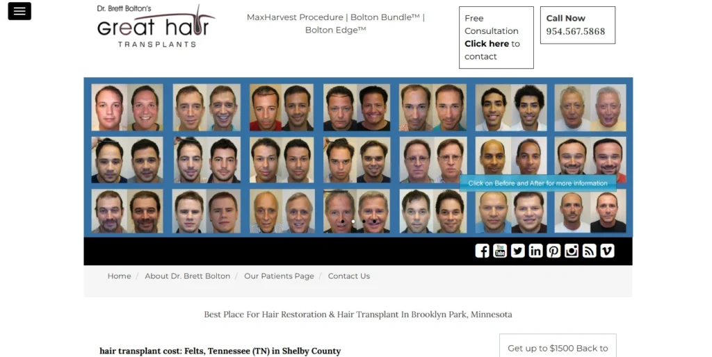 Great Hair Transplants