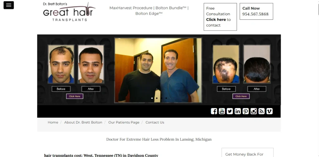 Great Hair Transplants