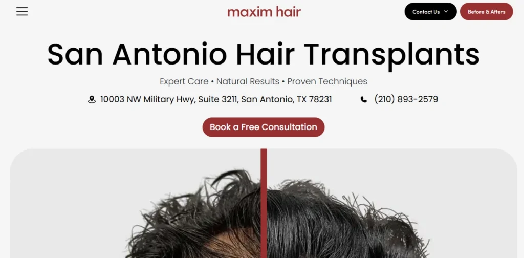 Maxim Hair Restoration San Antonio