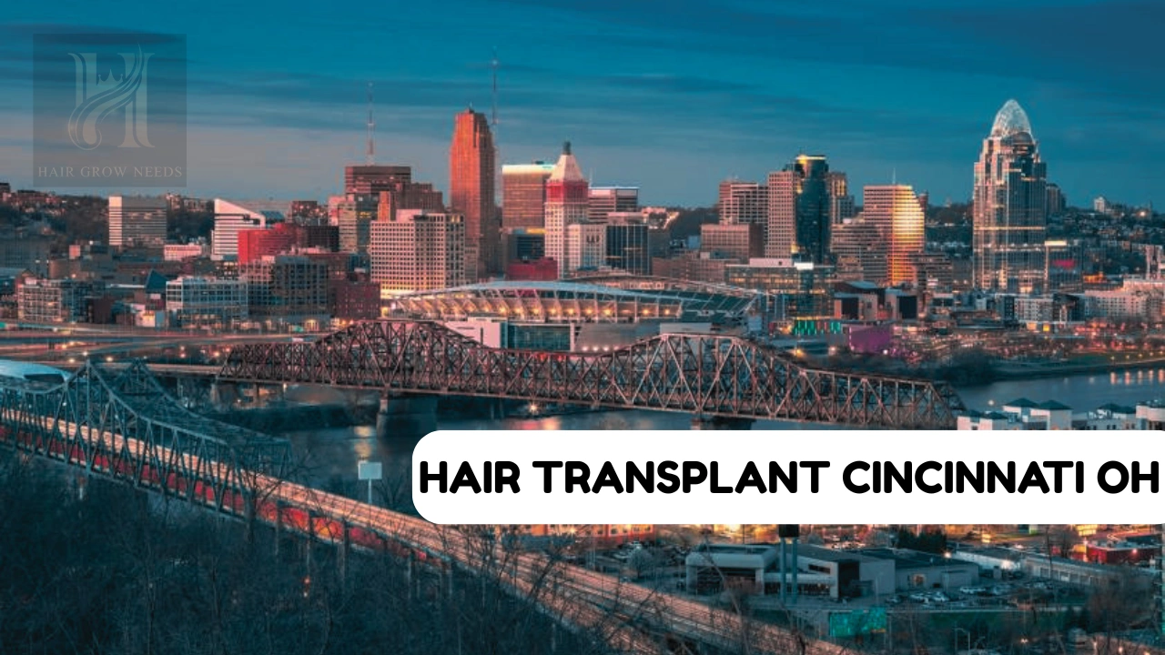 Hair Transplant Cincinnati OH 2026