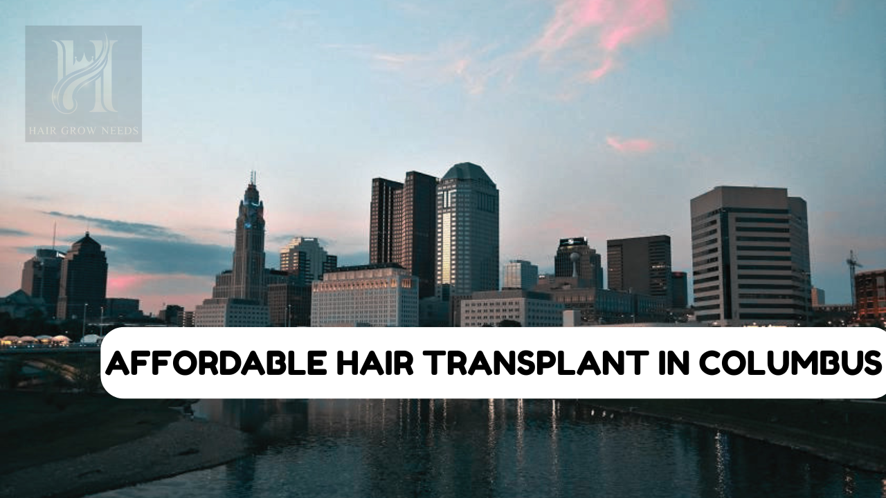 Hair Transplant Columbus