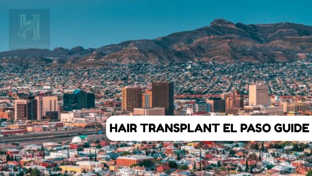 Hair Transplant El Paso