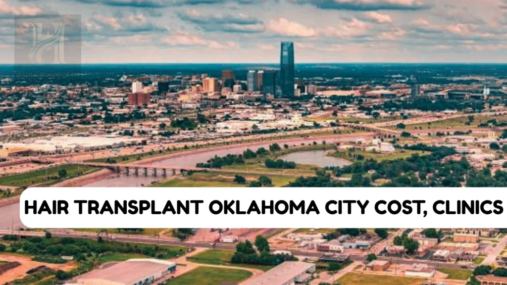 Hair Transplant Oklahoma City