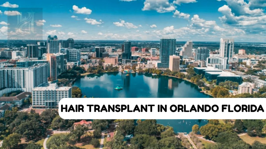 Hair Transplant Orlando Florida