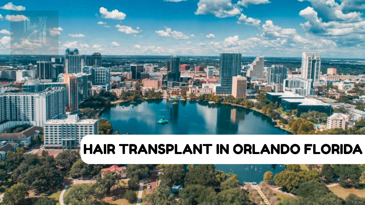 Hair Transplant Orlando Florida