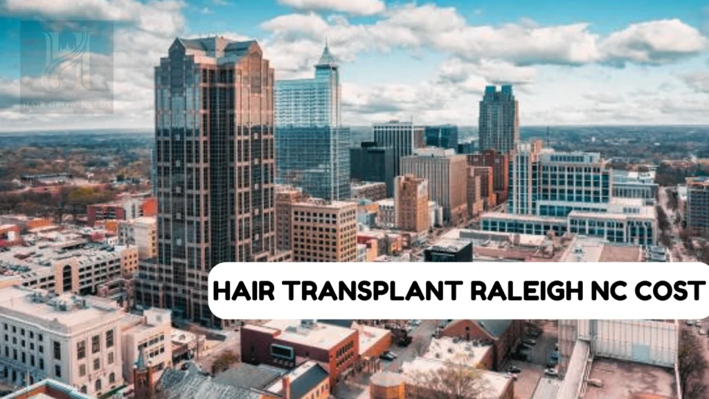 Hair Transplant Raleigh