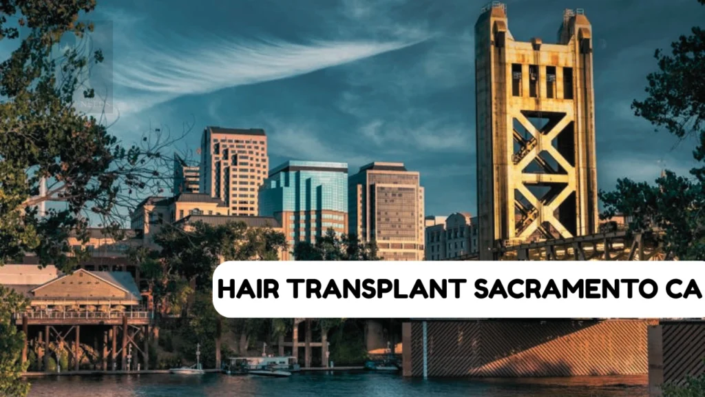 Hair Transplant Sacramento CA
