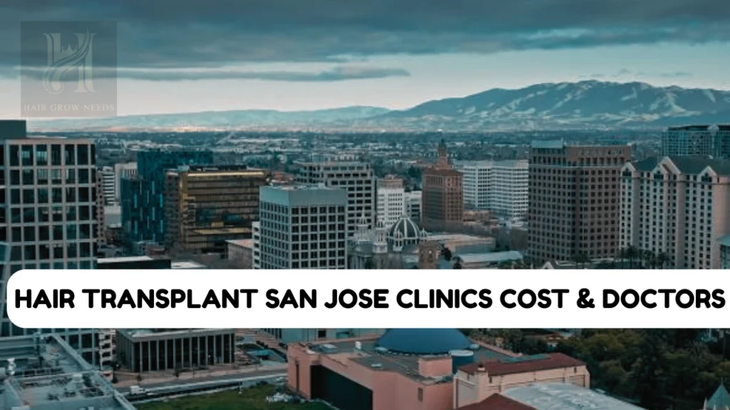 Hair Transplant San Jose