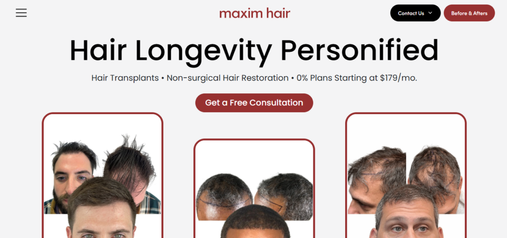 Maxim Hair Restoration & Transplants Dallas