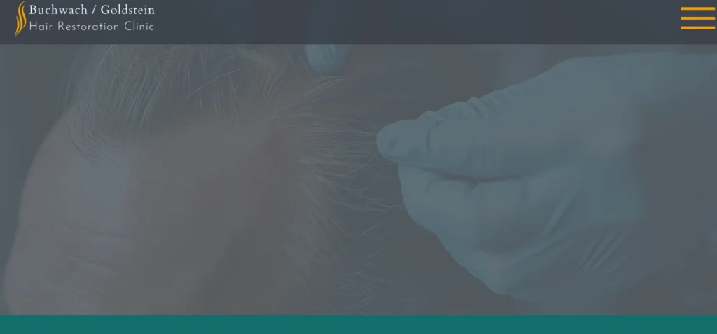 Buchwach Goldstein Hair Restoration