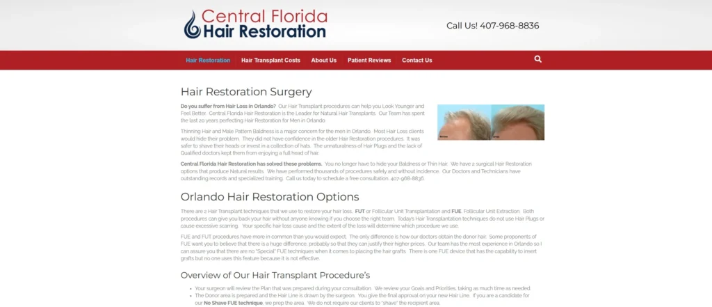 Central Florida Hair Restoration