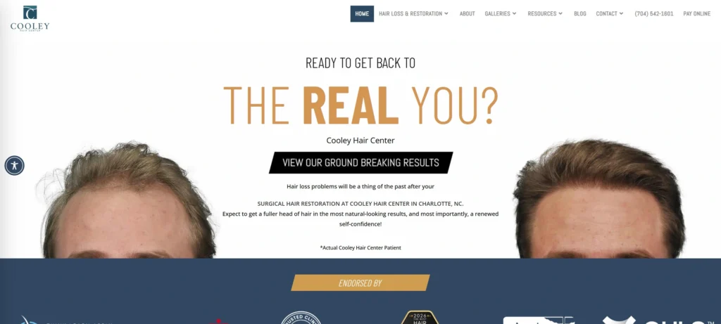 Cooley Hair Center Charlotte For Complex Cases