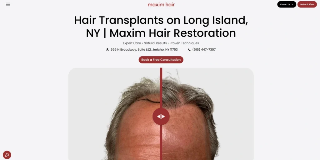 Maxim Hair Restoration Long Island