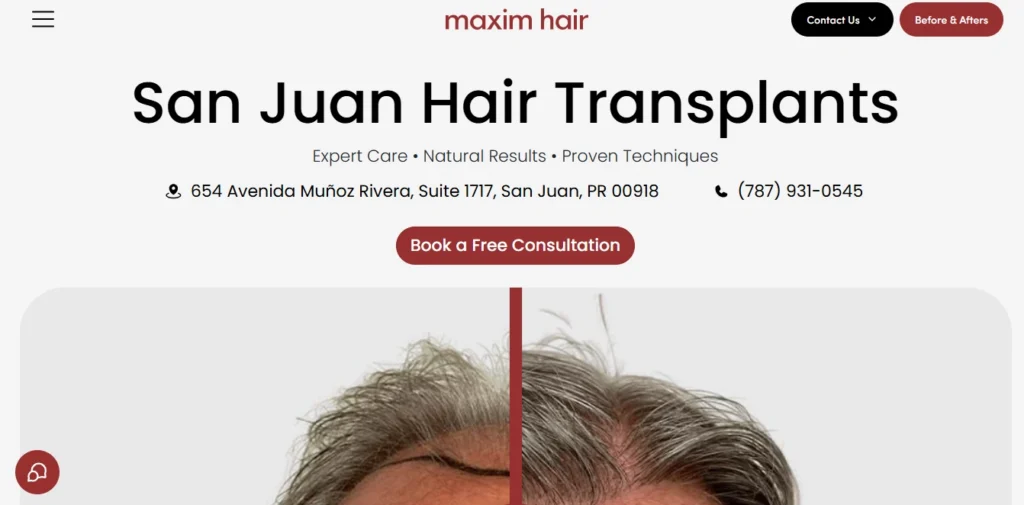 Maxim Hair Restoration San Juan
