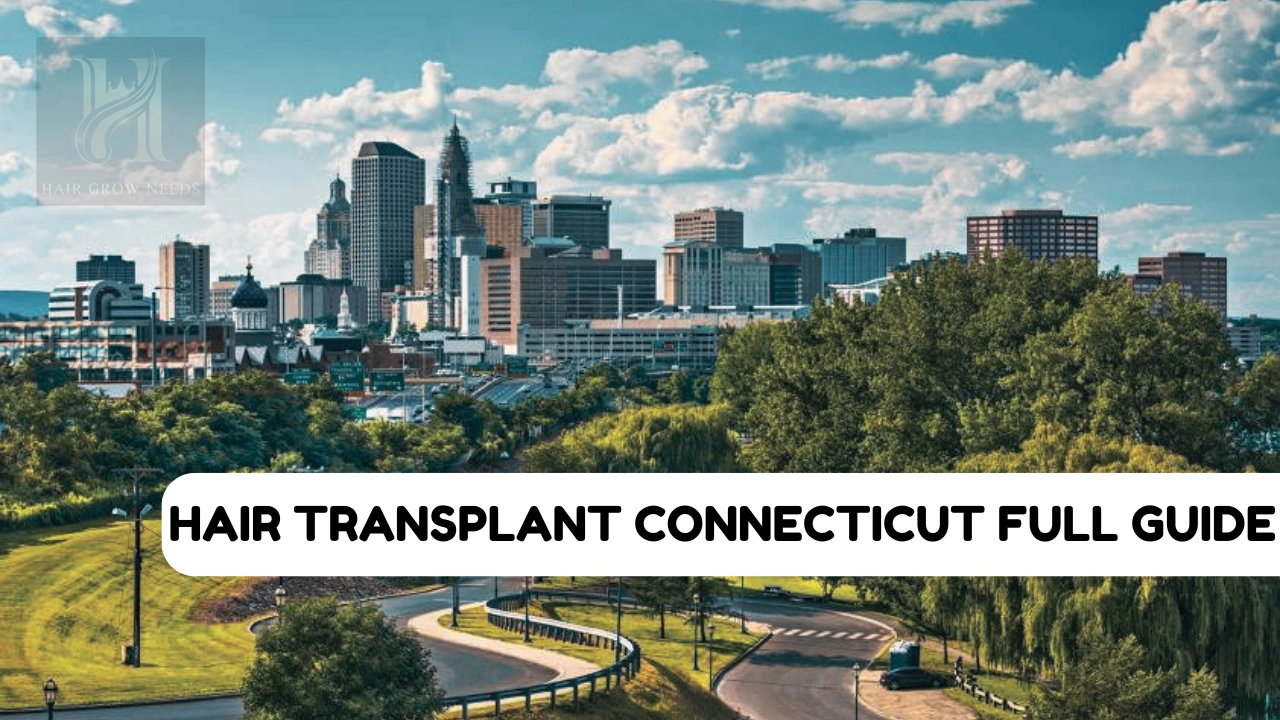 Hair Transplant Connecticut