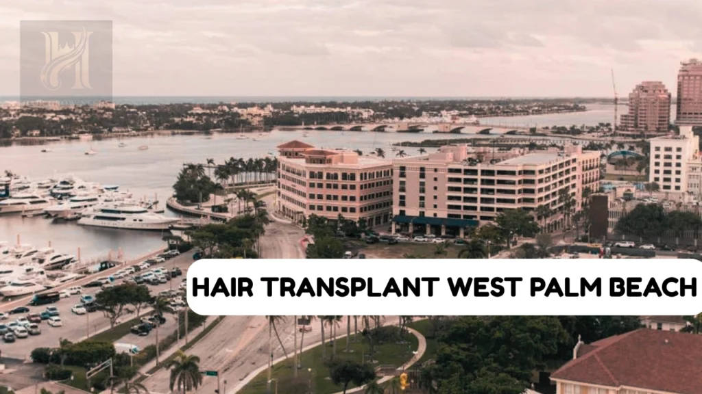 Hair Transplant West Palm Beach