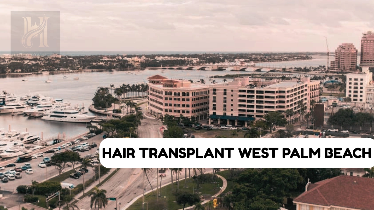 Hair Transplant West Palm Beach