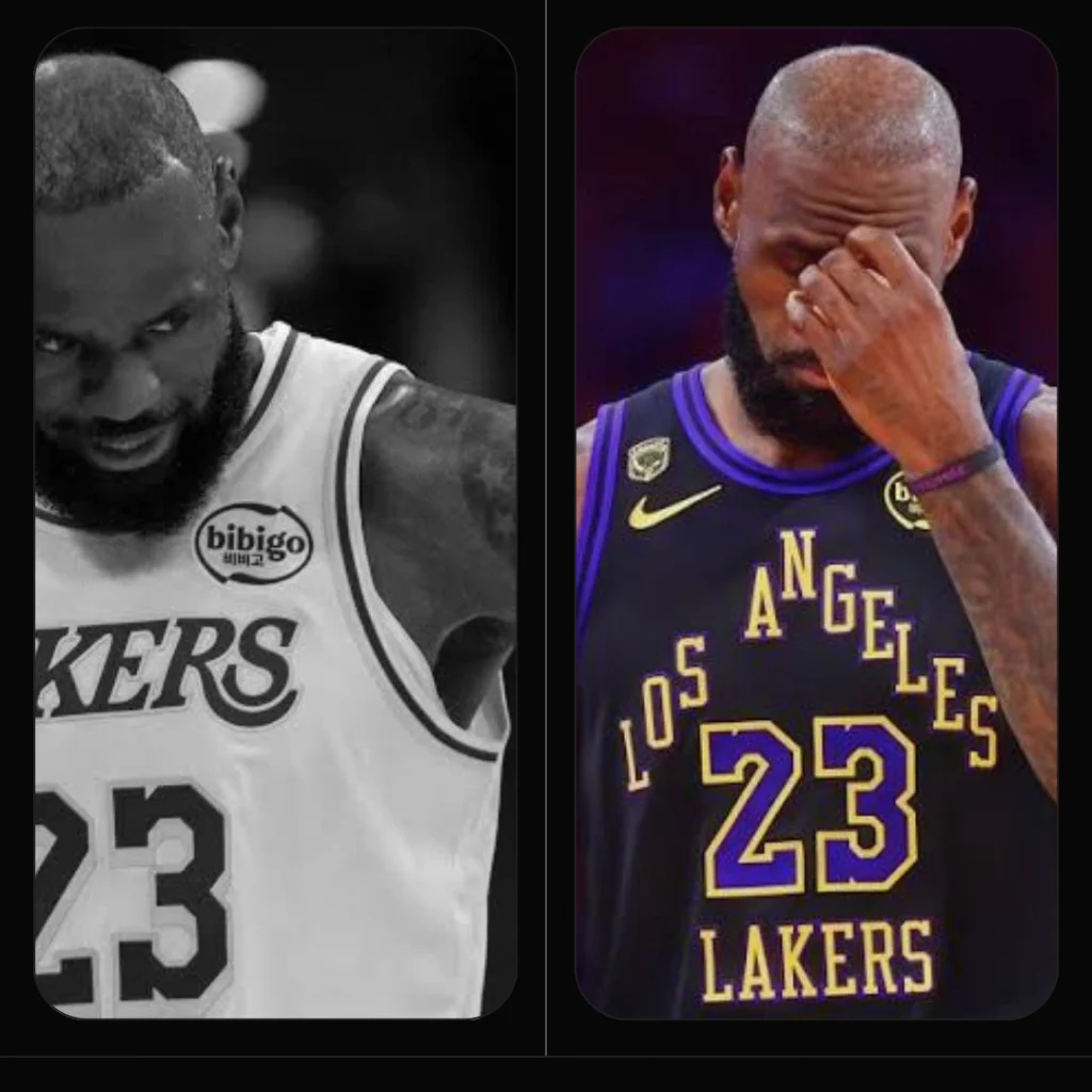 LeBron James hairline before suspected hair transplant showing temple recession